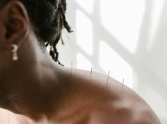 肩颈放血治疗肩周炎有用吗？了解利弊风险科学应对