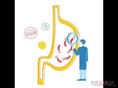 胆汁反流性胃炎中医辨证分型治疗全解