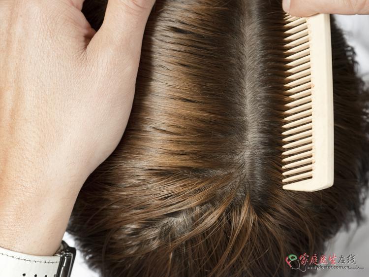 侧柏叶治白发靠谱吗？3个关键问题帮你避坑
