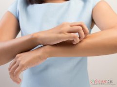 拔罐后皮肤瘙痒原因解析及科学缓解方法