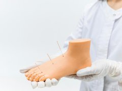 痔疮艾灸穴位选择与正确操作方法详解