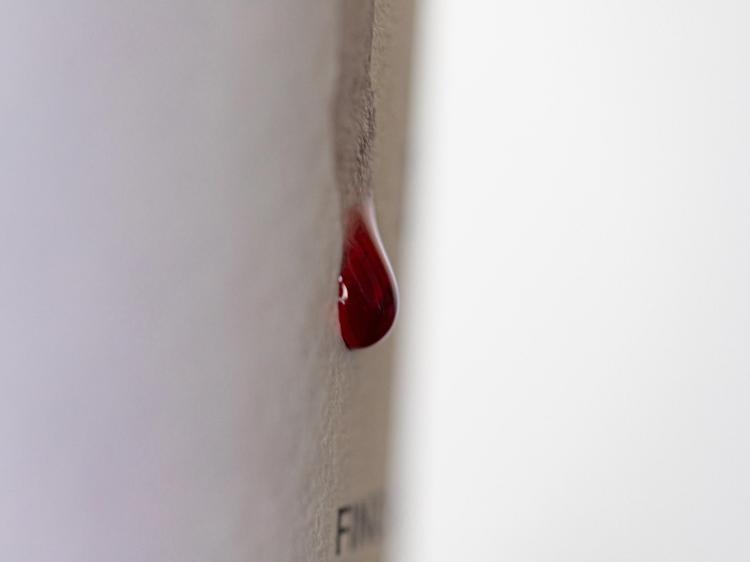 中医如何判断痛风？3个核心维度帮你精准识别