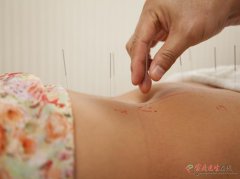 经期艾灸肚脐并非人人适用三类人群需谨慎判断