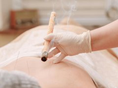 后天性癫痫中医治疗方法详解：中药针刺艾灸辅助调理