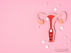 白带发黄是肾阴虚吗？中医解析白带异常真正原因