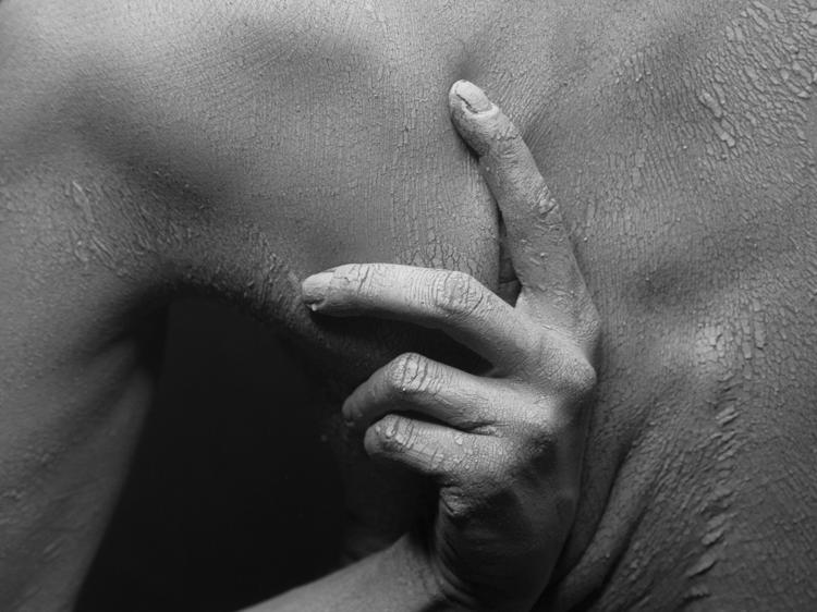 拔完火罐后背痒?3个原因+正确应对方法