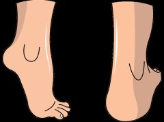 足跟疼不一定是肾虚！中医与西医解析疼痛真实成因及正确应对方法