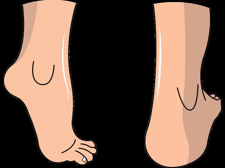 足跟疼不一定是肾虚，这些原因更常见