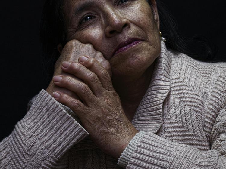 老年斑中医辨证饮食调理：内养改善肌肤状态