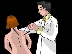 感冒时针灸有用吗？科学解析针灸辅助缓解症状的正确认知