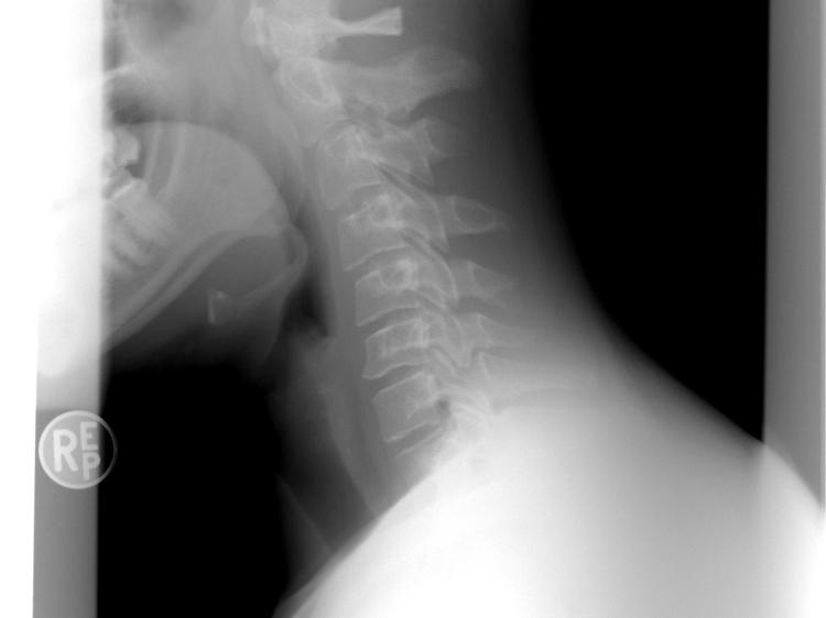 上肢麻木别硬扛：科学应对方法+避坑指南