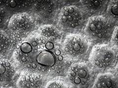 拔罐后水泡科学处理指南：小水泡不挑破，大水泡需排液
