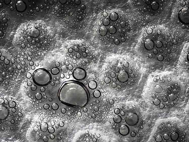 拔罐后起水泡?大小不同处理方法大不一样