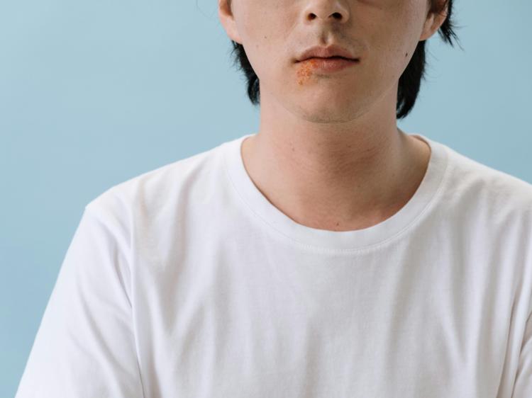 口腔溃疡疱疹与肾阴虚：科学区分与正确应对