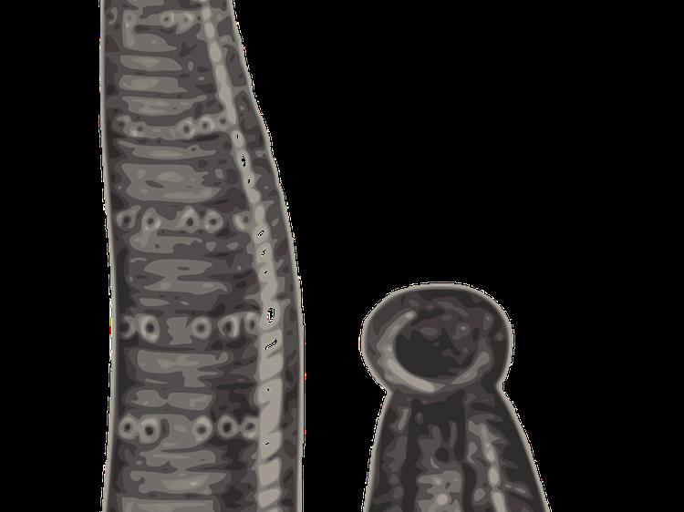 富贵包放血流淤血？科学解读+风险提示+正确干预