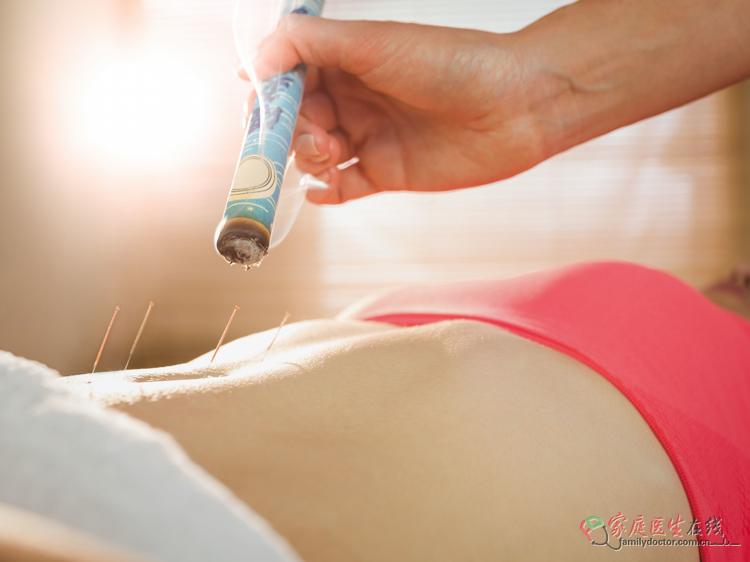 艾条熏小腹：虚寒证调理+3类问题适用+避坑指南