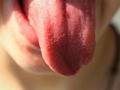 舌苔颜色厚度异常与健康信号解析