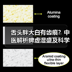 舌头胖大白有齿痕？中医解析脾虚湿盛及科学调理方案（图3）