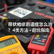 带状疱疹后遗症怎么治？4类方法+避坑指南（图4）