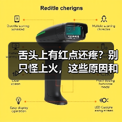 舌头上有红点还疼?别只怪上火,这些原因和应对方法要知道(图1) 舌头上有红点还疼?别只怪上火,这些原因和应对方法要知道(图1)