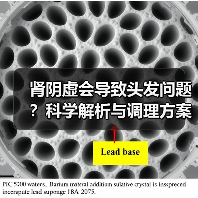 肾阴虚会导致头发问题?科学解析与调理方案(图3) 肾阴虚会导致头发问题?科学解析与调理方案(图3)