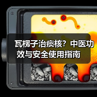 瓦楞子治痰核?中医功效与安全使用指南(图4) 瓦楞子治痰核?中医功效与安全使用指南(图4)