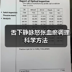 舌下静脉怒张血瘀调理科学方法（图3）