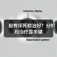 股骨坏死能治好？分阶段治疗是关键（图2）