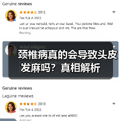 颈椎病真的会导致头皮发麻吗?真相解析(图3) 颈椎病真的会导致头皮发麻吗?真相解析(图3)