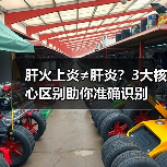 肝火上炎≠肝炎?3大核心区别助你准确识别(图2) 肝火上炎≠肝炎?3大核心区别助你准确识别(图2)