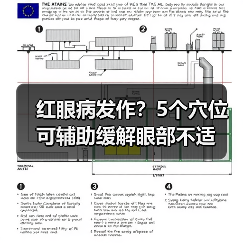 红眼病发作?5个穴位可辅助缓解眼部不适(图1) 红眼病发作?5个穴位可辅助缓解眼部不适(图1)